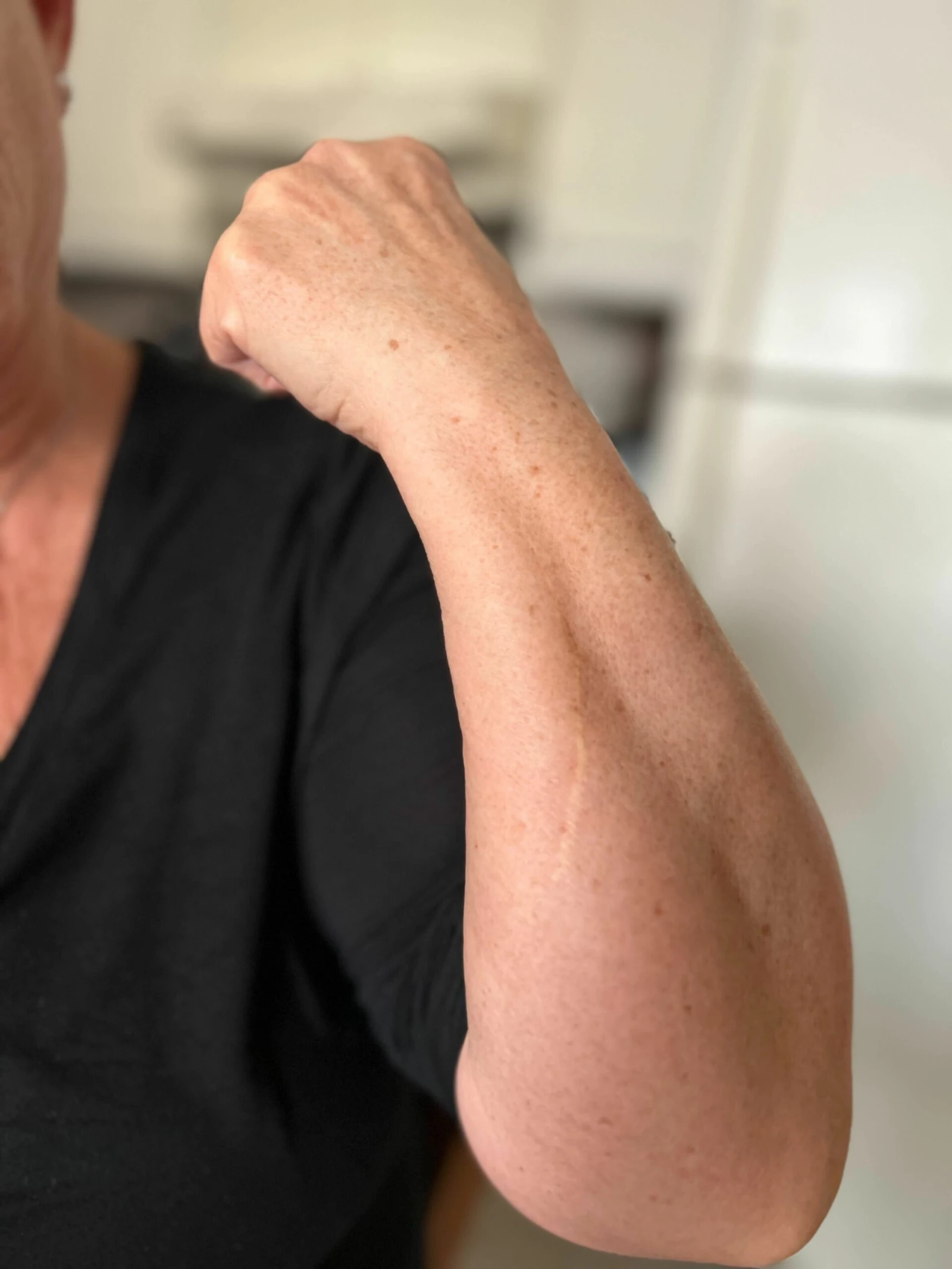 Monique portera toujours les cicatrices de ce moment.