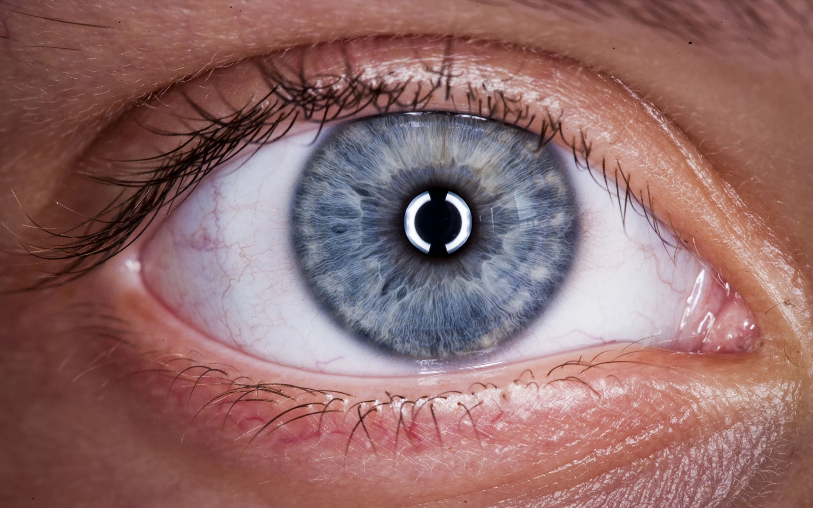 MYOPIE (n. f.) / mjɔpi   Trouble de la vision (temporaire ou pas) qui peut apparaître avec l’allongement des globes oculaires lors d’une poussée de croissance. Comme quoi aucun organe n’est à l’abri du bordel pubertaire. ***