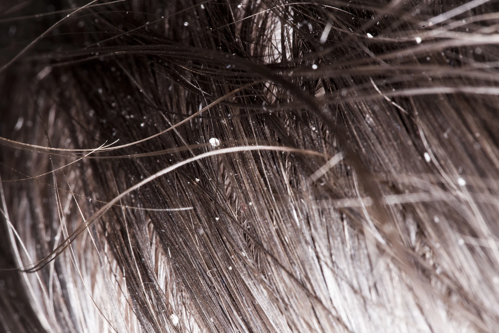 FULL GRASSOU (expression) / ful ɡʁasu   Condition causée par le maelström de sécrétions-massives-de-sébum-cuir-chevelu-pubère-habitudes-d’hygiène-qui-n’ont-pas-tout-à-fait-suivi. Idéal pour un petit look « loutre mouillée ». ***